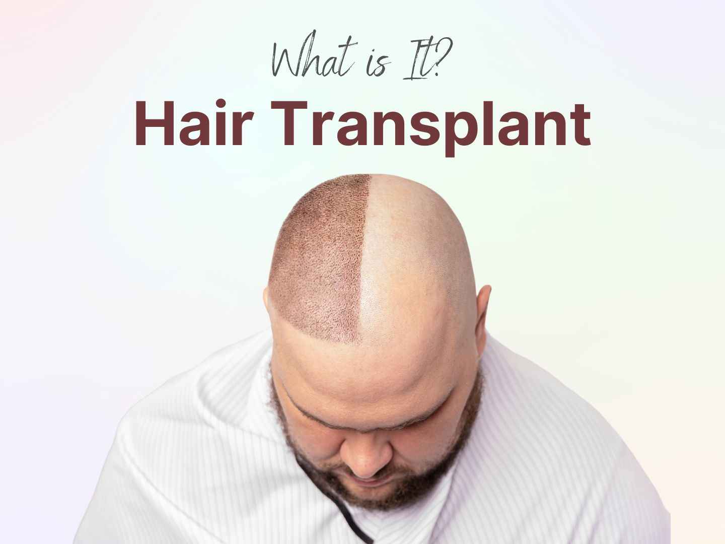 How Hair Transplants Can Boost Your Confidence and Appearance